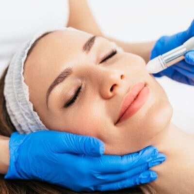 What-Makes-Microneedling-Effective-for-Skin-Care
