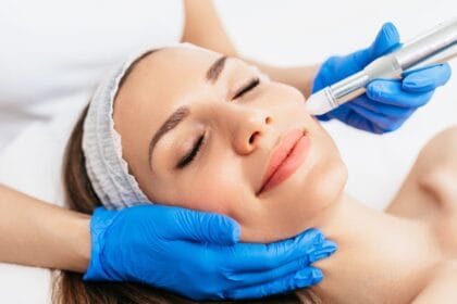 What-Makes-Microneedling-Effective-for-Skin-Care