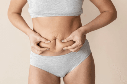 What-Mini-Abdominoplasty-Does-for-Your-Tummy