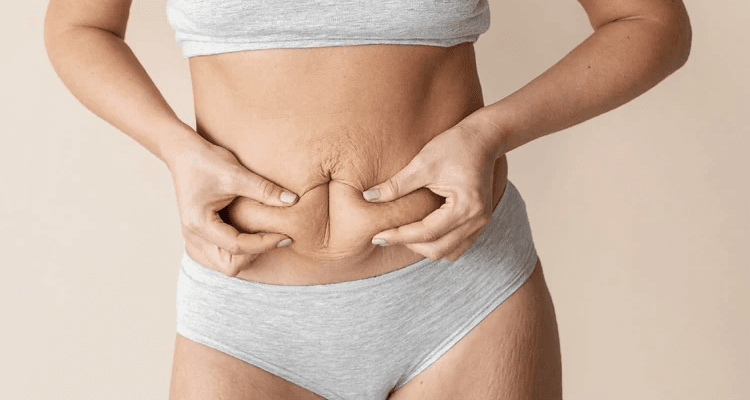 What-Mini-Abdominoplasty-Does-for-Your-Tummy